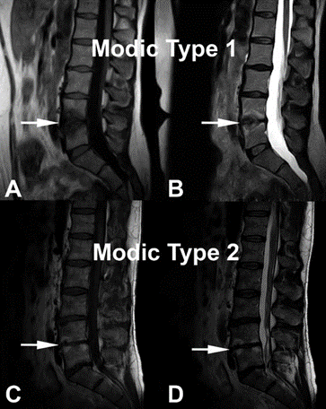 ISASS Policy Statement 2022– Systematic review of Intraosseous ...